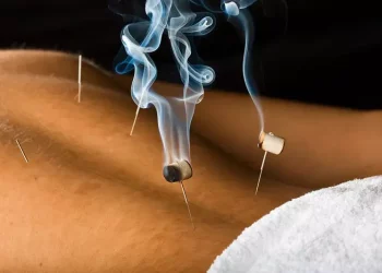 Is Moxibustion or Cupping Therapy More Effective Than Medication in Treating Chronic Fatigue?