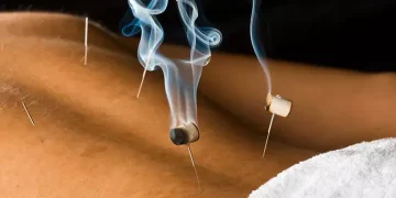 Is Moxibustion or Cupping Therapy More Effective Than Medication in Treating Chronic Fatigue?